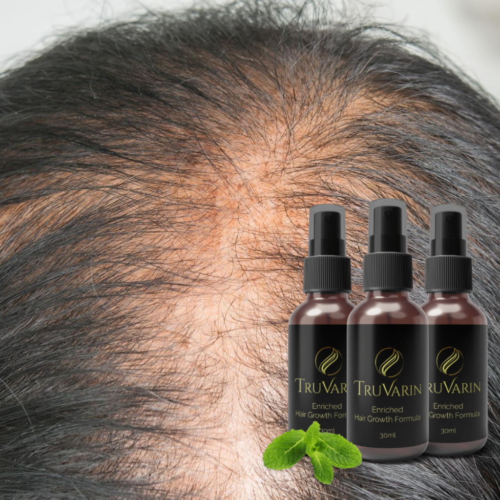 TRUVARIN: The Hair Growth Solution Have you ever looked in the mirror and wished for a miracle to restore volume and vitality to your hair ...